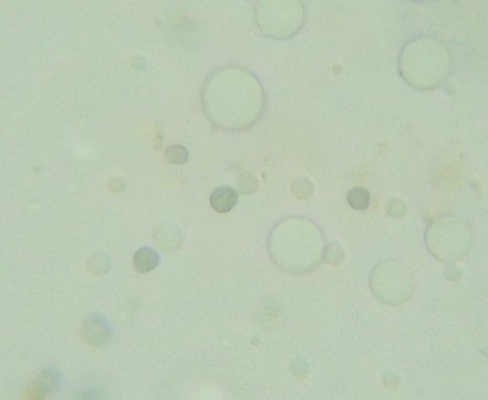 Amyloid Amanita spores bobbyb.JPG